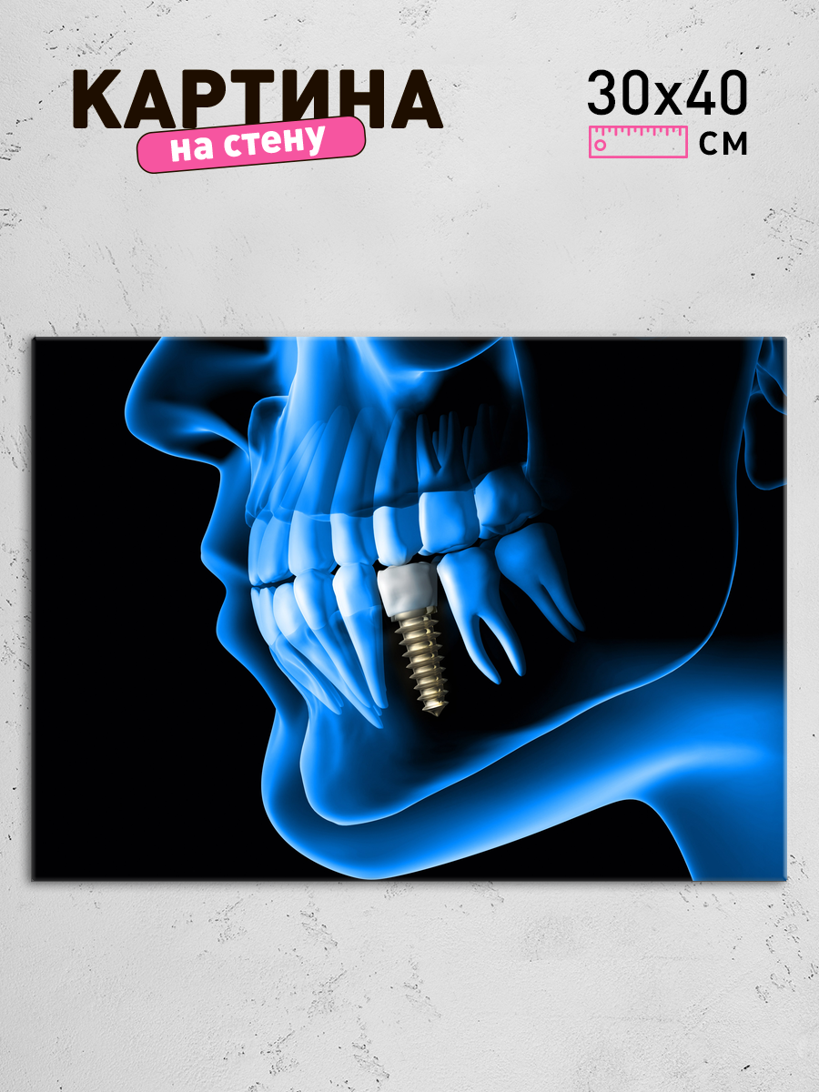 Обработанное