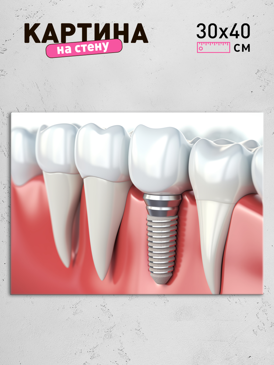 Обработанное